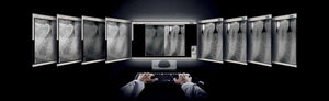 Radiografía digital: ¿Cómo se mide la calidad de las imágenes obtenidas por un equipo de rayos X digital intraoral?