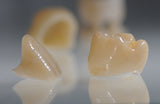 VarseoSmile Crown plus