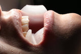 Retractor Oral Ophis en funcionamiento aislando lengua y mejillas.